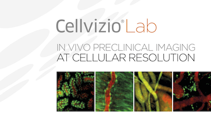 Brochure Cellvizio Lab 2017 - WEB.jpg Brochure Cellvizio Lab 2017 - WEB.jpg