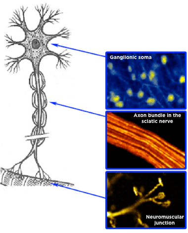 peripheral_nerve_380x470_001.png peripheral_nerve_380x470_001.png