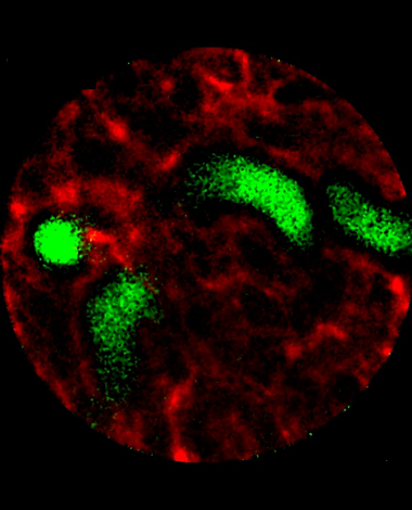 renal_fibrosis_380x470_001.png renal_fibrosis_380x470_001.png