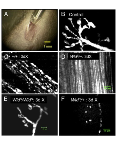 degenerating_axons_380x470_001.png degenerating_axons_380x470_001.png
