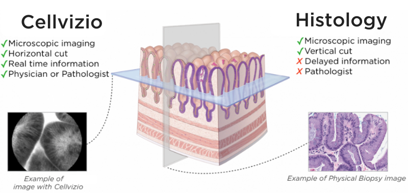 Cellvizio vs. Histology.png Cellvizio vs. Histology.png