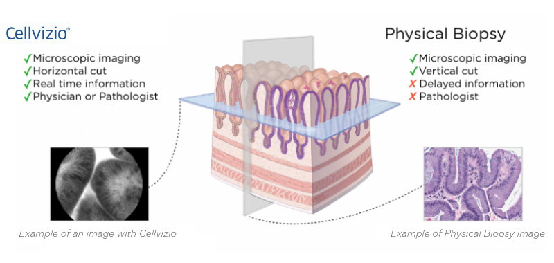 800x380 Cellvizio physical biopsy.png 800x380 Cellvizio physical biopsy.png