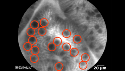 2 Dark mucin in goblet cells easily identified.png