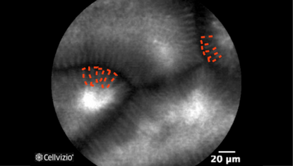 3 Homogeneous epithelial cells.png