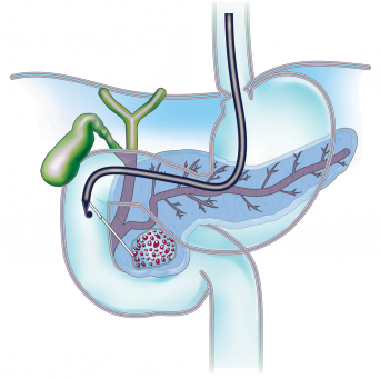 Pancreas blue.png Pancreas blue.png
