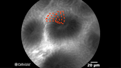 3 Homogeneous epithelial cells.png