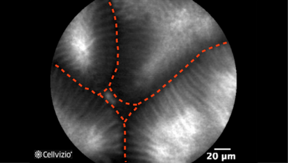 2 Pyloric glands.png