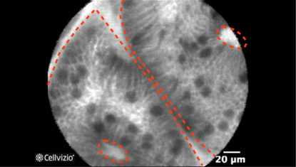 5 Glands equal in size and shape.png