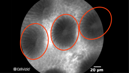 2 Regular ranged glands, homogeneous in size and epithelial heights.png