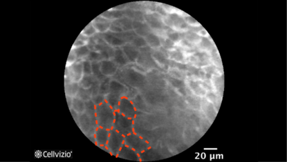 1 Squamous epithelium with flat and scale-like cells.png