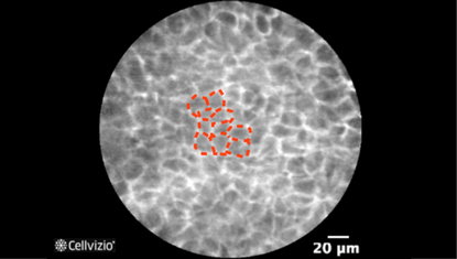 2 Intermediate cells (smaller and under the surface).png