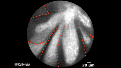 Papillary projection2.png