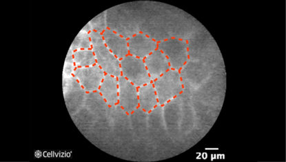 1 Umbrella cells (flat and large on the surface).png