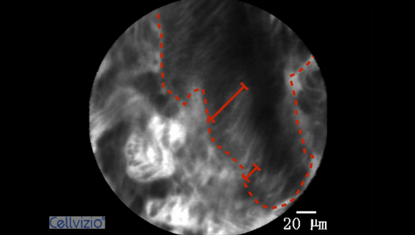 2 Variable width of the epithelial lining.png 2 Variable width of the epithelial lining.png