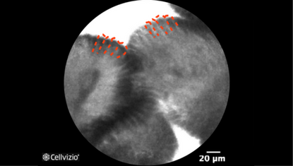 4 Slender tall and bright absorptive cells.png