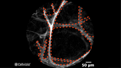 1 Thin regular alveolar septi.png