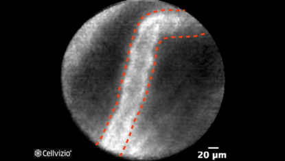 1 Thickened reticular structures.png