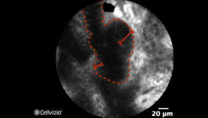 2 Variable width of the epithelial lining.png 2 Variable width of the epithelial lining.png