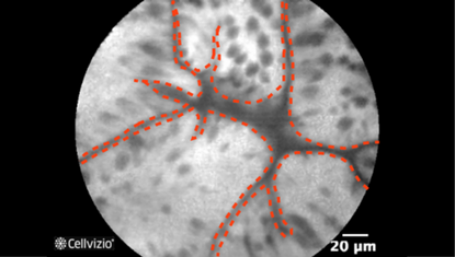 2 Crypts with slit or stellate openings (pits).png