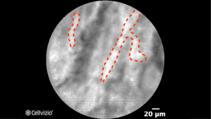 3 Vessels (<20 microns).png