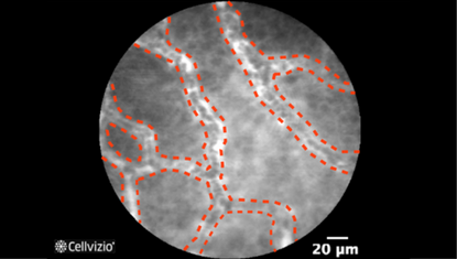 3 Lamina Propria with regular network of blood vessels.png