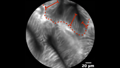 2 Variable width of the epithelial lining.png 2 Variable width of the epithelial lining.png