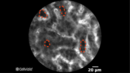 3 Small cells arranged in clusters.png 3 Small cells arranged in clusters.png