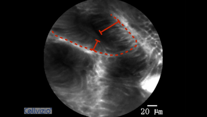 2 Variable width of the epithelial lining.png 2 Variable width of the epithelial lining.png