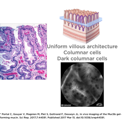 Visualize goblet cells.png