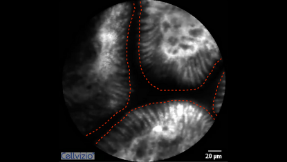 1 Dark lumen (space between villi).png