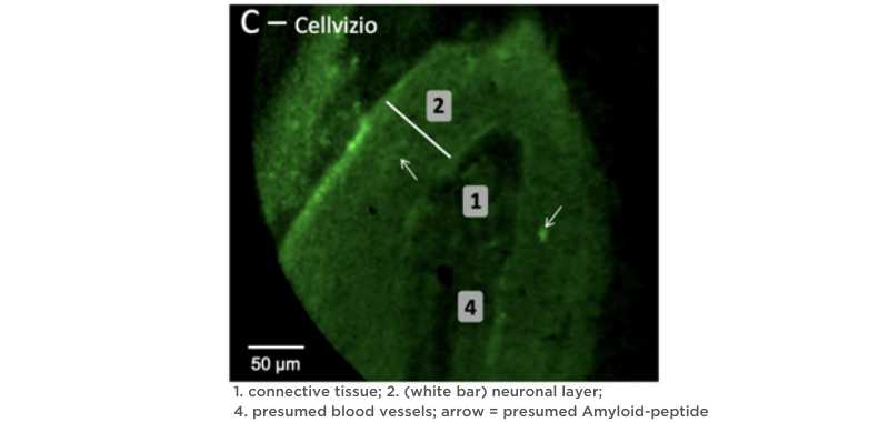 Lung Image CLE.png