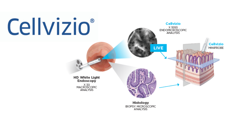Cellvizio technology.png Cellvizio technology.png