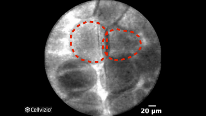 Adipocytes.png Adipocytes.png
