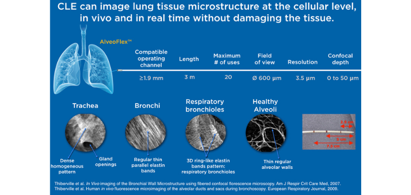 Lung Tissue Microstructure.png