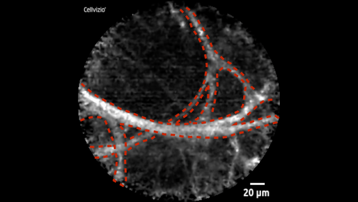 Alveoli thumbnail.png